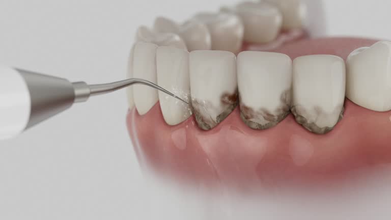 Reliable Tooth Extraction contractor in Elm City, NC by Smile Center Dentistry